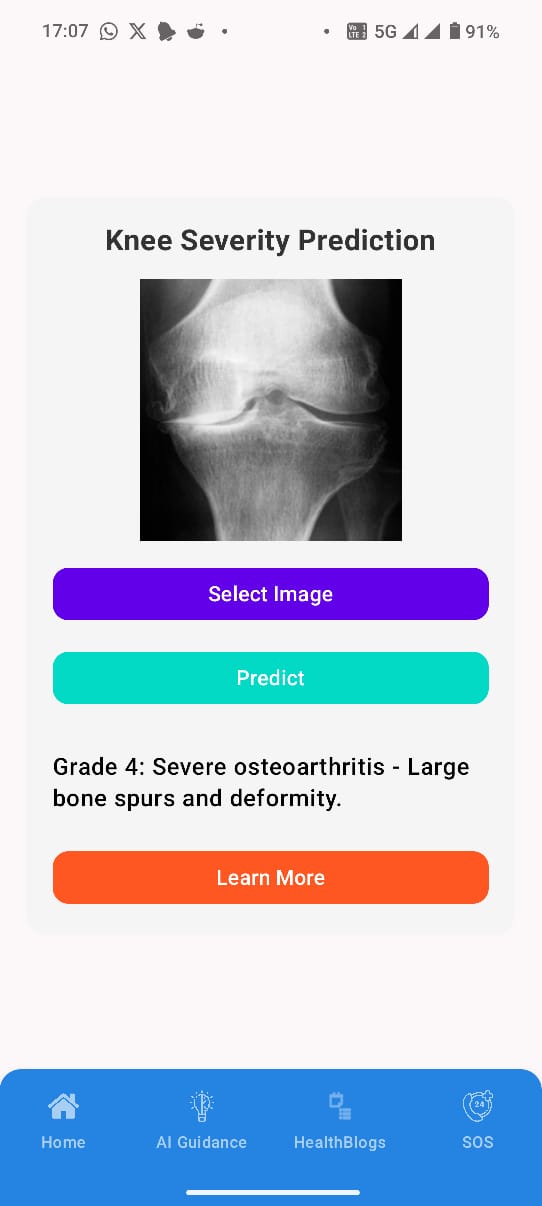 Sehat Saathi - AI app for joint analysis, disease prediction, cost insights & instant guidance