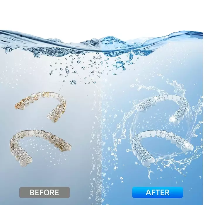 DentaSonic Ultrasonic Retainer Cleaner