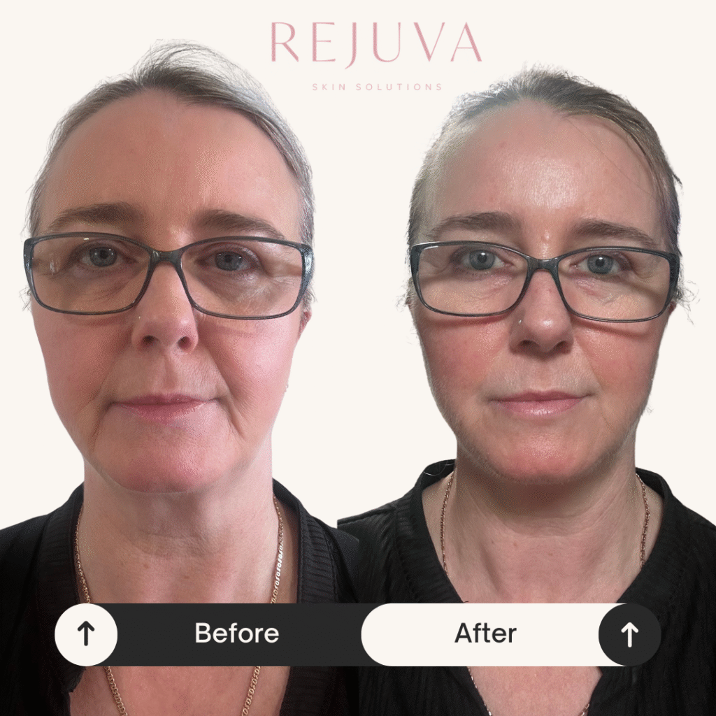 Golden Tree Collagen Derma Lift Netherlands: Waarom dit het beste collageensupplement voor jou is Golden Tree Collagen Derma Lift Netherlands: Waarom dit het beste collageensupplement voor jou is