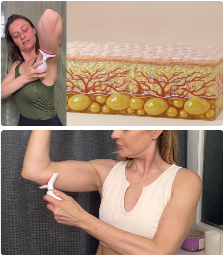 Why MyoGlow Skin Tightener is Dominating Arm Firming Trends in 2026