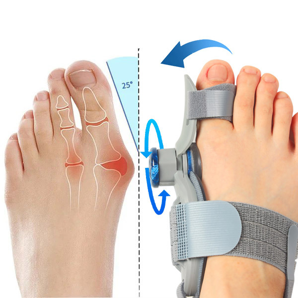 BuniCure Bunion Brace Review: Comfortable Daily Foot Support Explained (AU) BuniCure Bunion Brace Review: Comfortable Daily Foot Support Explained (AU)