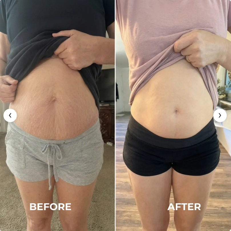 MyoGlow Skin Tightener: Features, Working Mechanism & Honest User Results