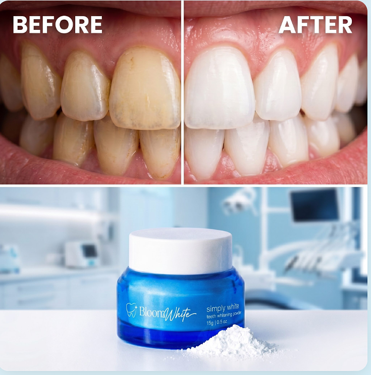 Bloom White Teeth Whitening Powder Bloom White Teeth Whitening Powder