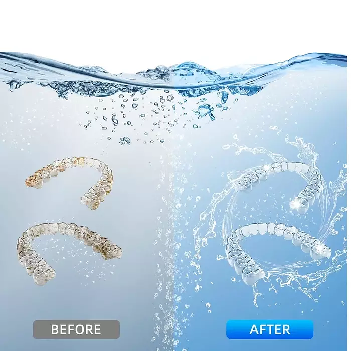 DentaSonic Ultrasonic Retainer Cleaner