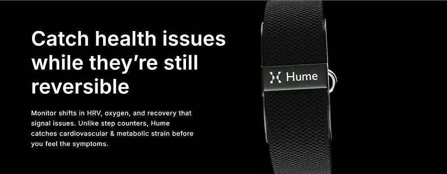 Hume Health Wrist Band (Official™) - Is It Worth the Hype? Hume Health Wrist Band (Official™) - Is It Worth the Hype?