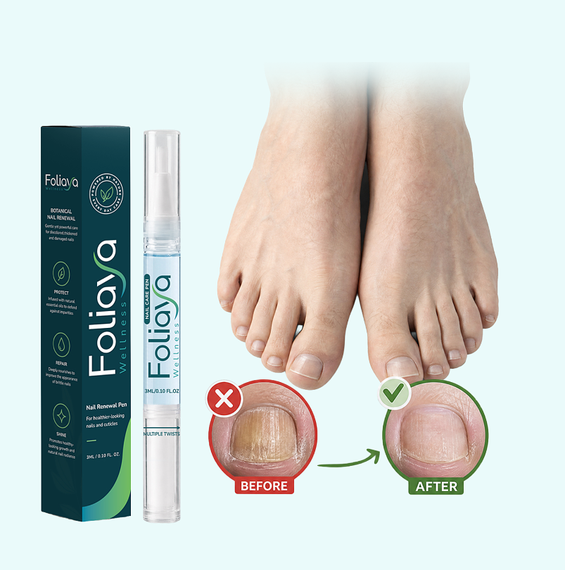 Foliaya Anti-Fungal Pen Complete Breakdown: Is It Worth Your Money? Foliaya Anti-Fungal Pen Complete Breakdown: Is It Worth Your Money?
