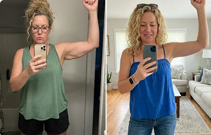 Why MyoGlow Skin Tightener is Dominating Arm Firming Trends in 2026