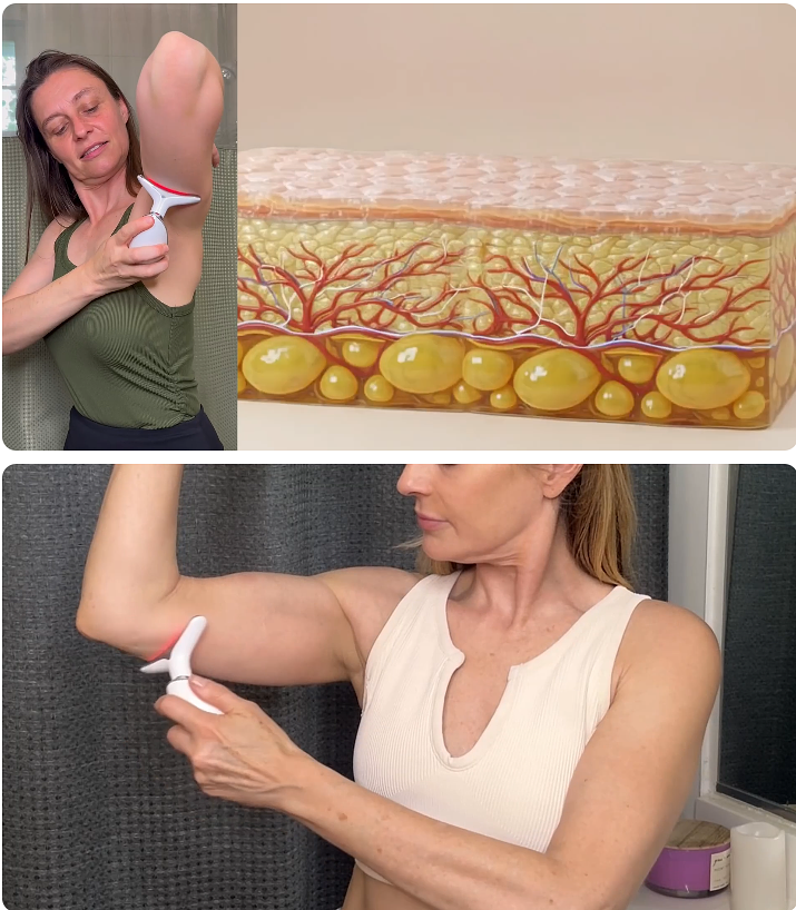 MyoGlow Skin Tightener: Features, Working Mechanism & Honest User Results